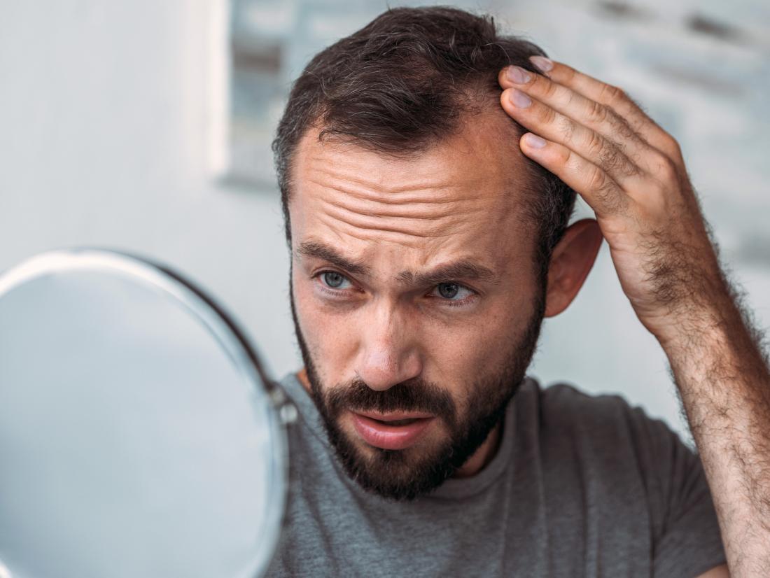 15-things-that-help-stop-hair-loss-in-men-15-things-that-help-stop